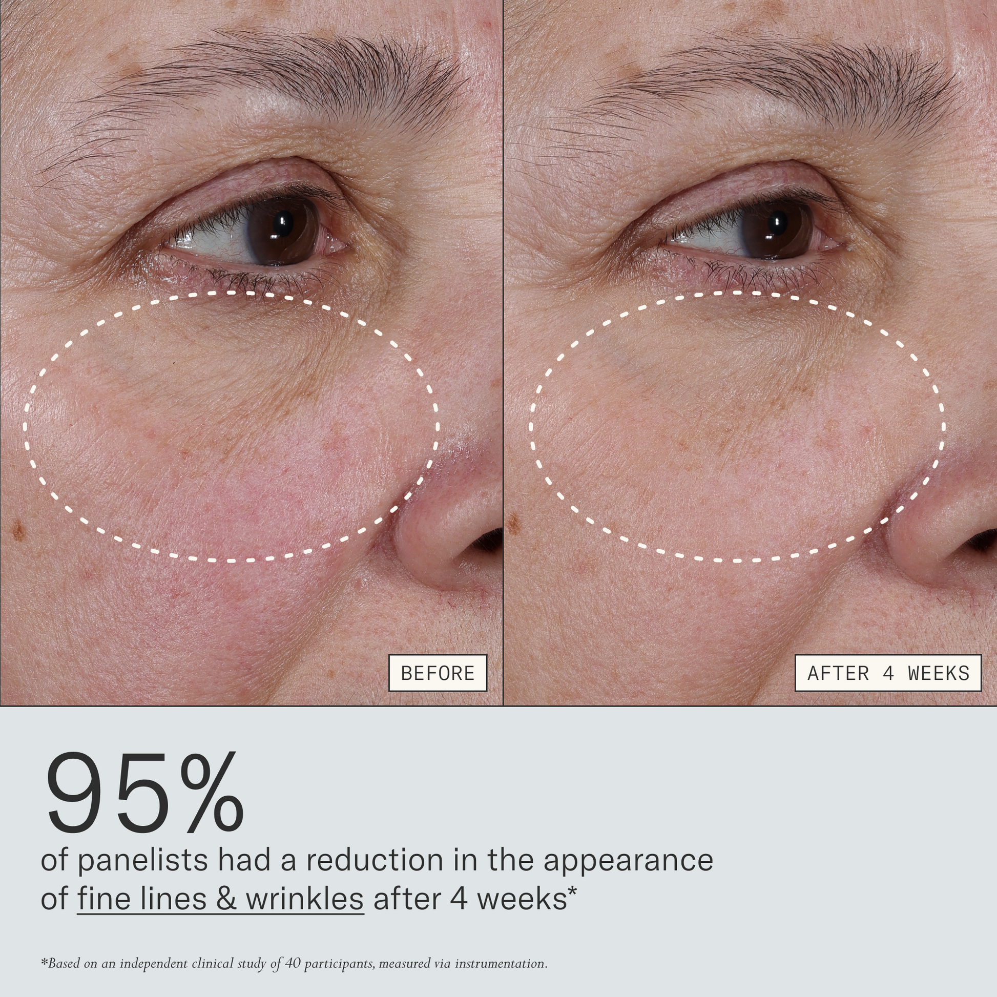 Deliverance clinical results graphic showing reduced fine lines and wrinkles after 4 weeks