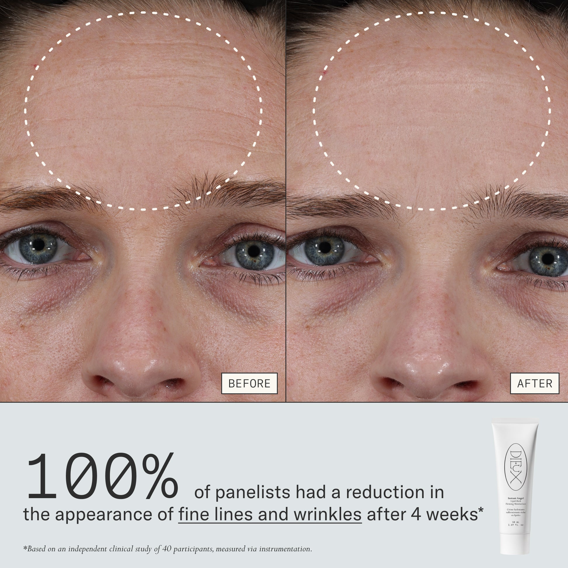 Dieux Plump & Barrier Boost Kit skincare bundle