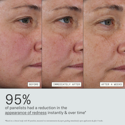 Deliverance clinical results graphic showing reduced redness over time
