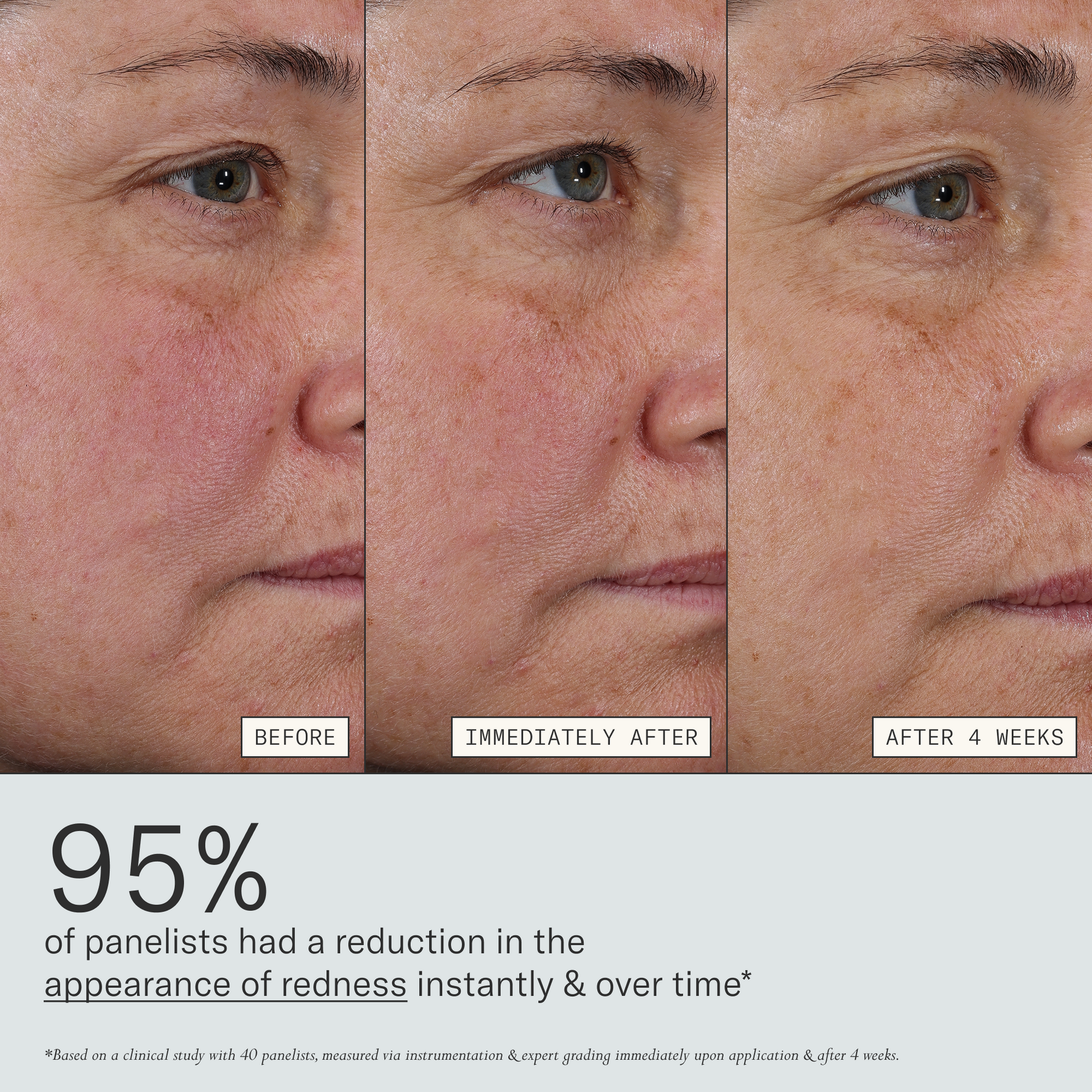 Deliverance clinical results graphic showing reduced redness over time