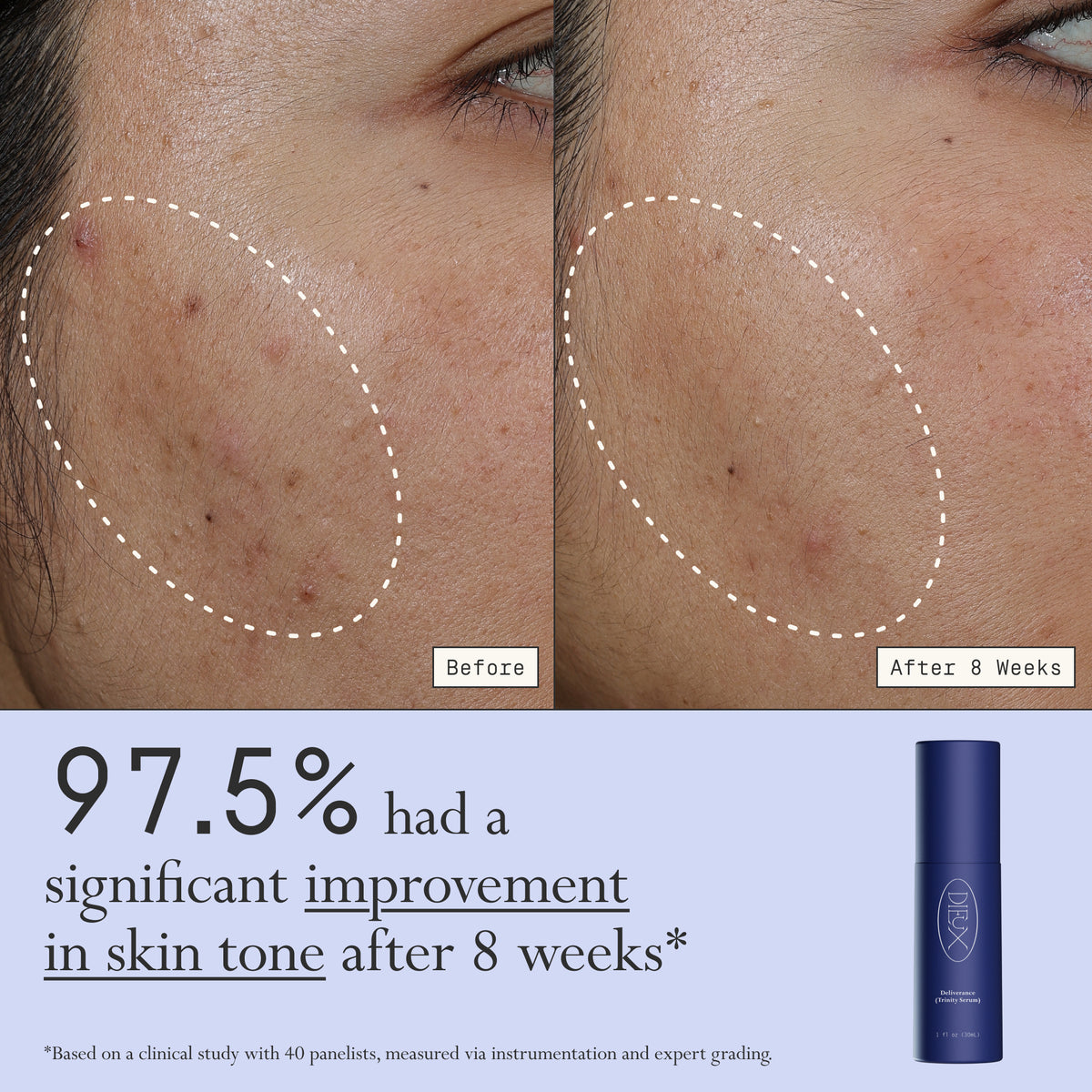 Images of a model before and after 8 weeks of using Dieux Deliverance Serum.

Text: 97.5% had a significant improvement in skin tone after 8 weeks