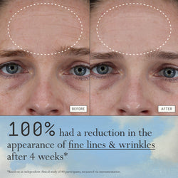 Instant Angel clinical results graphic showing reduced fine lines after 4 weeks