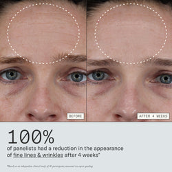 Before and after images from clinical study that shows Dieux Instant Angel Lipid Rich Firming Moisturizer minimizes the look of wrinkles & fine lines over 4 weeks.