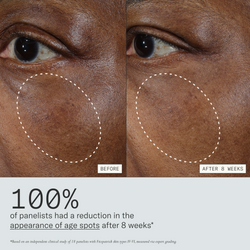 Deliverance clinical results graphic showing reduced dark spots after 8 weeks