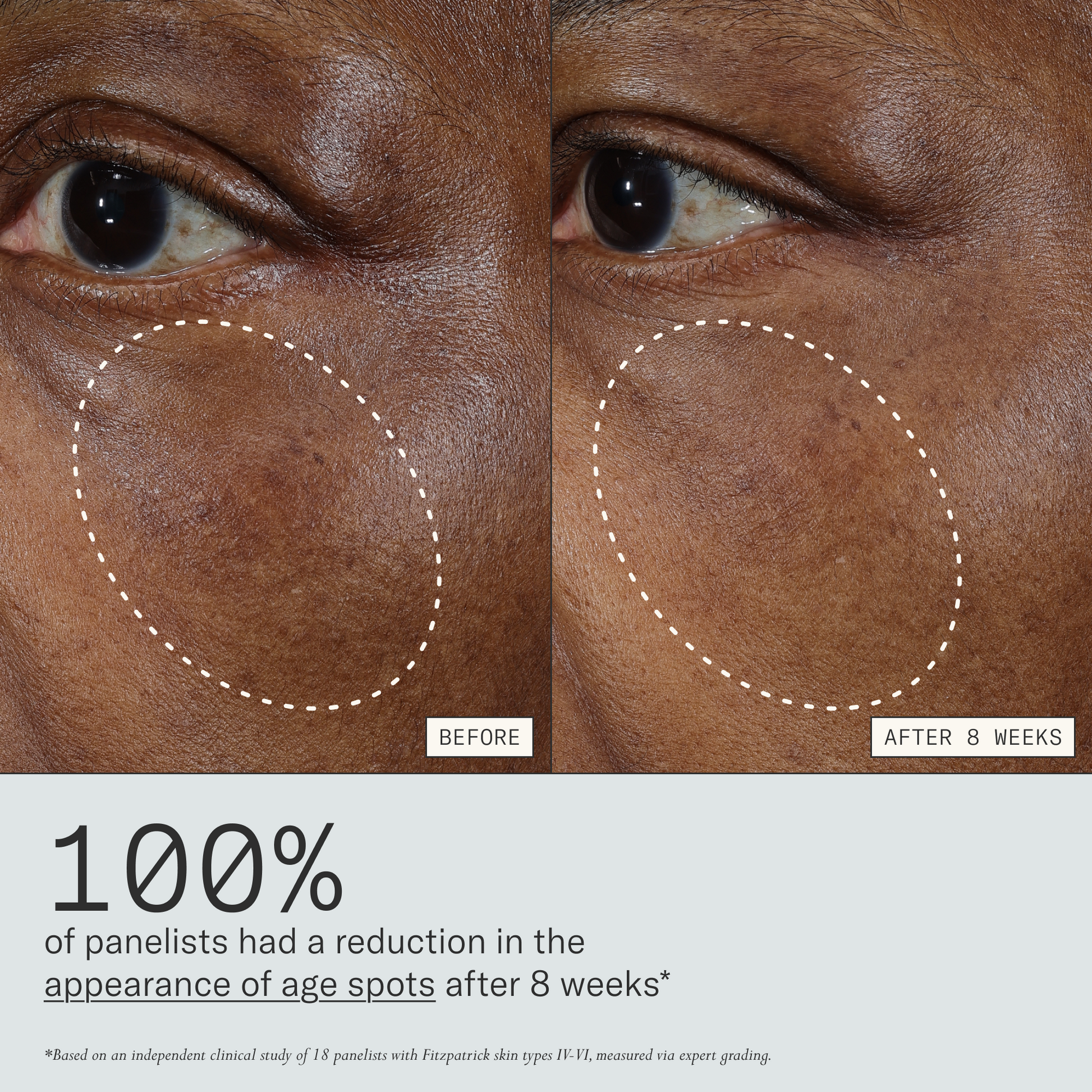 Deliverance clinical results graphic showing reduced dark spots after 8 weeks