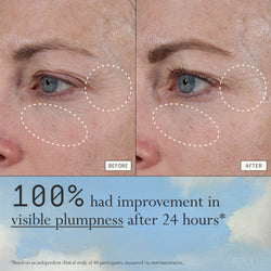 Instant Angel clinical results graphic showing improved visible plumpness after 24 hours