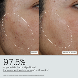 Deliverance clinical results graphic showing improved skin tone after 8 weeks