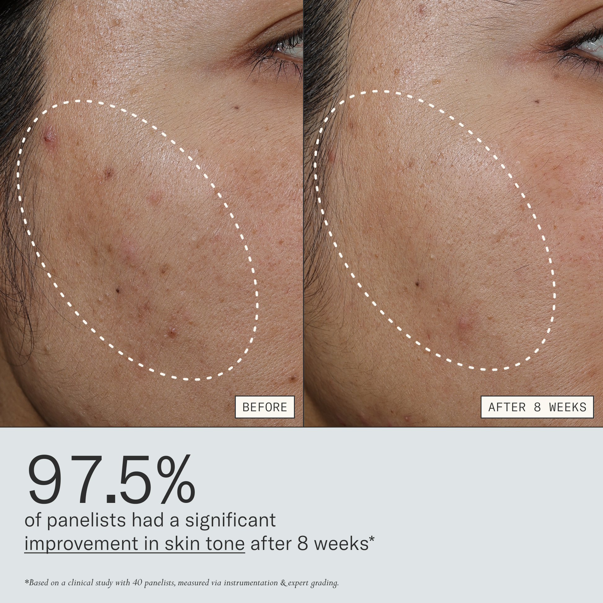 Deliverance clinical results graphic showing improved skin tone after 8 weeks