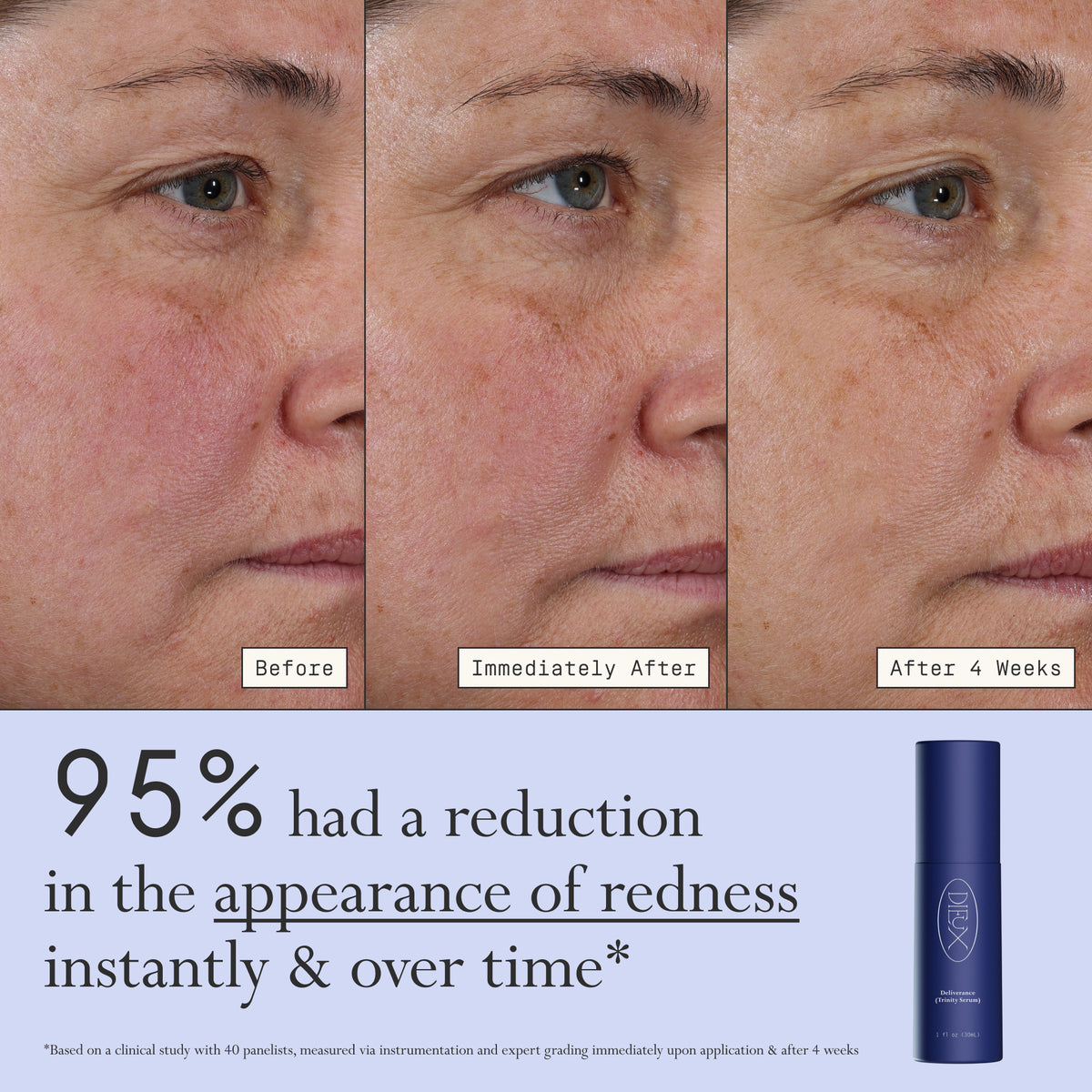 Images of a model before, immediately after, and after 4 weeks of using Dieux Deliverance Serum.

Text: 95% had a reduction in the appearance of redness instantly & over time.