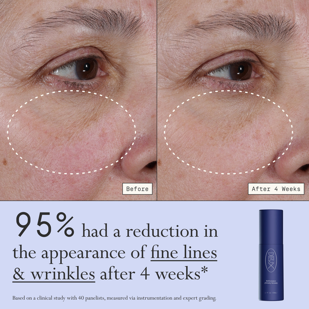Images of a model before and after 4 weeks of using Dieux Deliverance Serum.

Text: 95% had a reduction in the appearance of fine lines & wrinkles after 4 weeks