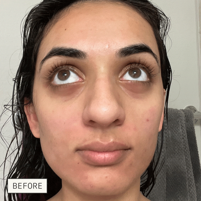 Dieux Deliverance 3-in-1 Repair Serum before-and-after skincare result
