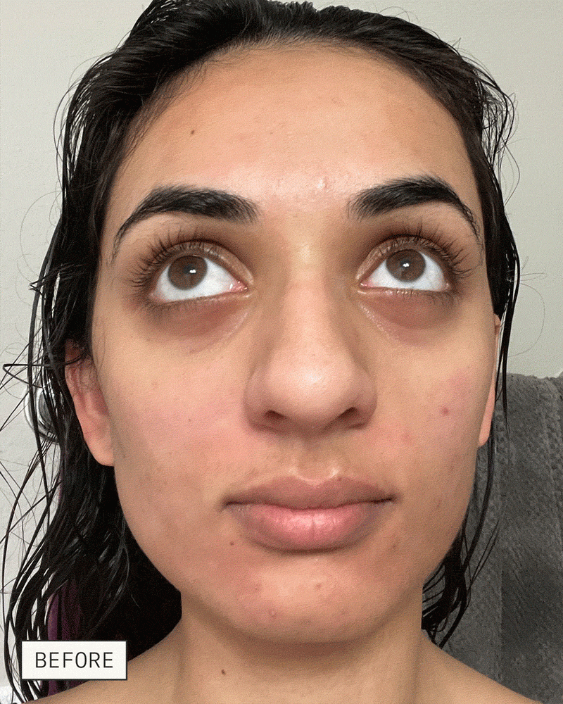 Dieux Deliverance 3-in-1 Repair Serum before-and-after skincare result