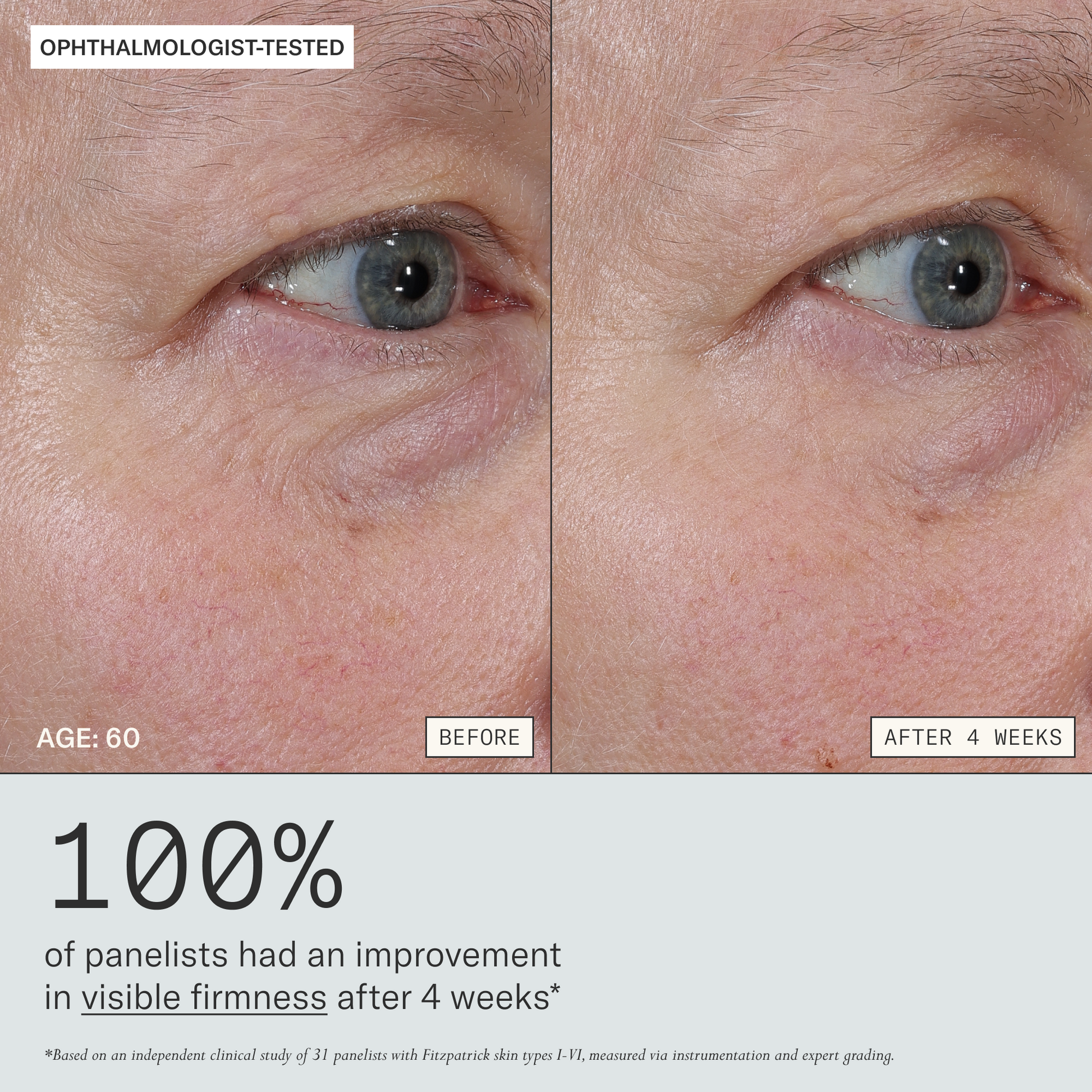 Firm Revival HydroRetinal Firming Serum before and after 4 weeks for a 60 years old participant. 100% of panelists had an improvement in visible firmness after 4 weeks. Based on an independent clinical study of 31 panelists with Fitzpatrick skin types I-VI, measured via instrumentation and expert grading. Ophthalmologist-tested.