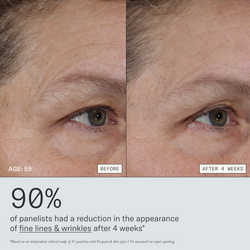 Firm Revival HydroRetinal Firming Serum before and after 4 weeks for a 59 years old participant. 90% of panelists had a reduction in the appearance of fine lines & wrinkles after 4 weeks. Based on an independent clinical study of 31 panelists with Fitzpatrick skin types I-VI, measured via instrumentation and expert grading. 