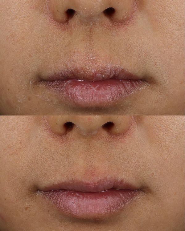 Dieux Skin Mercy clinical result graphic