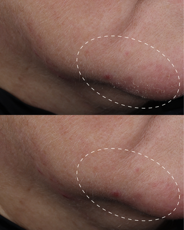 Dieux Skin Mercy clinical result graphic