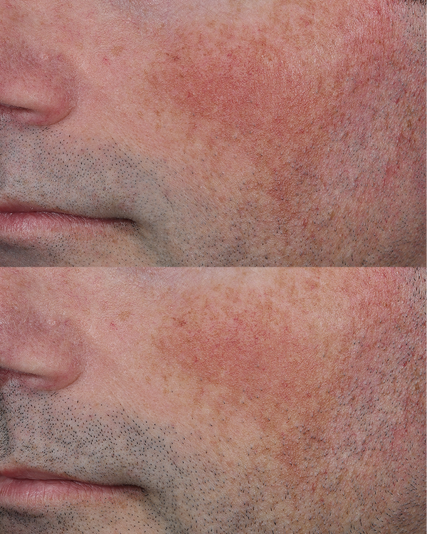 Dieux Skin Mercy clinical result graphic