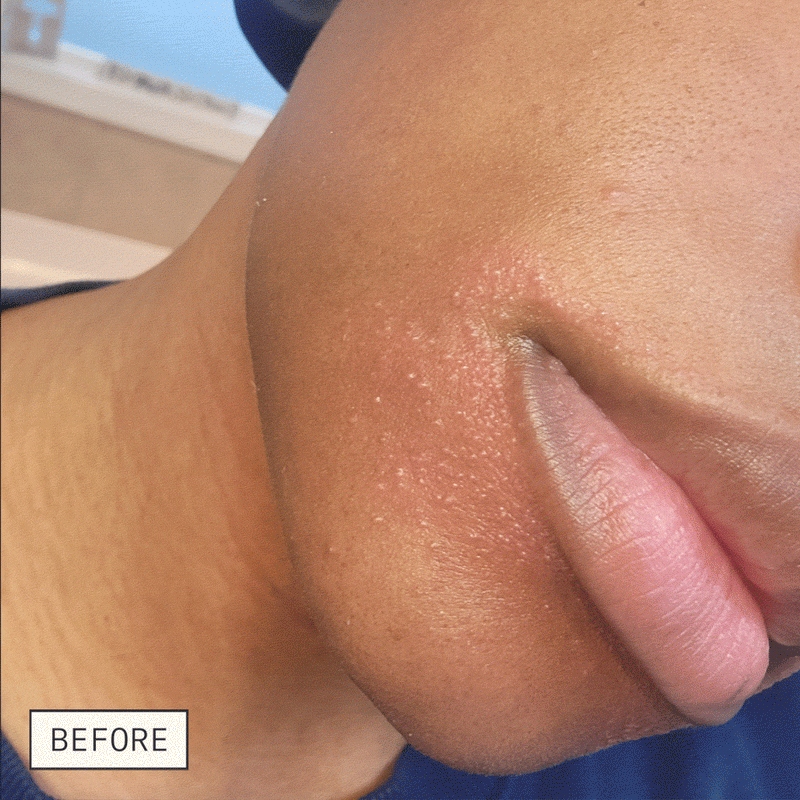 Dieux Skin Mercy Recovery Cream before-and-after skincare result