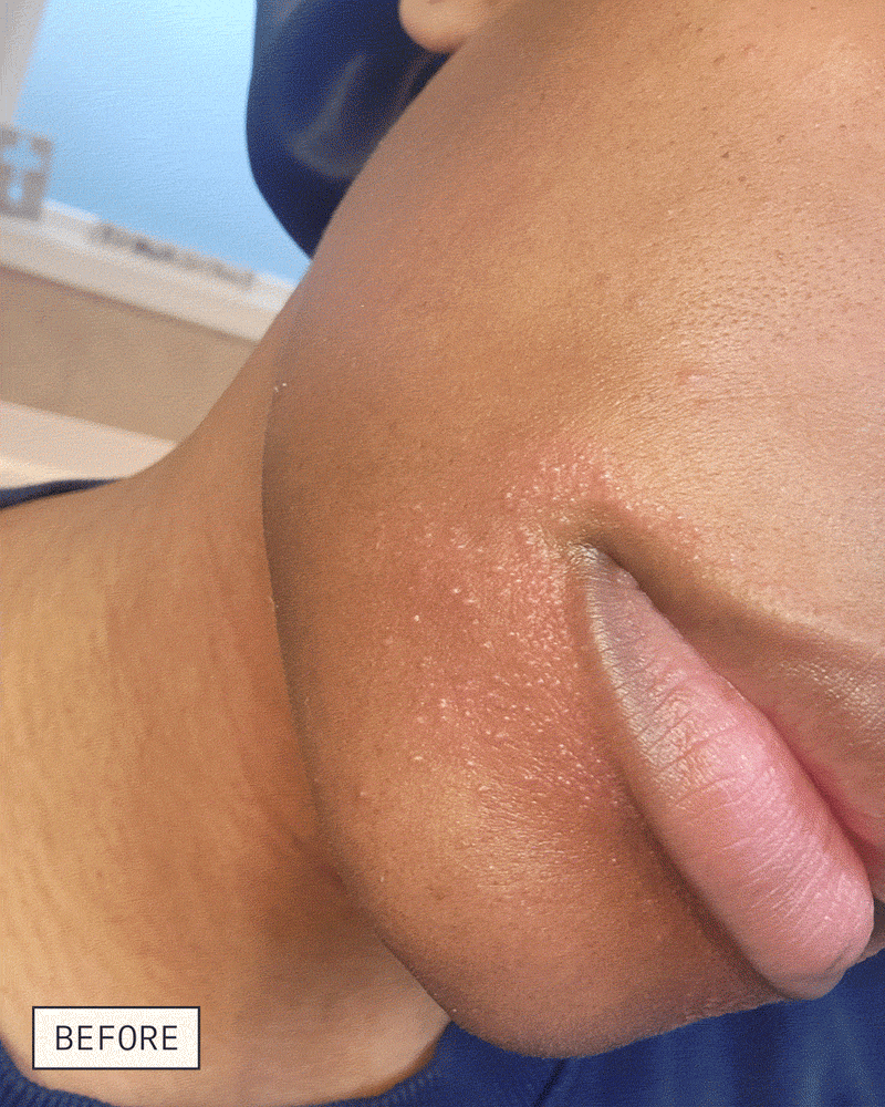 Dieux Skin Mercy Recovery Cream before-and-after skincare result